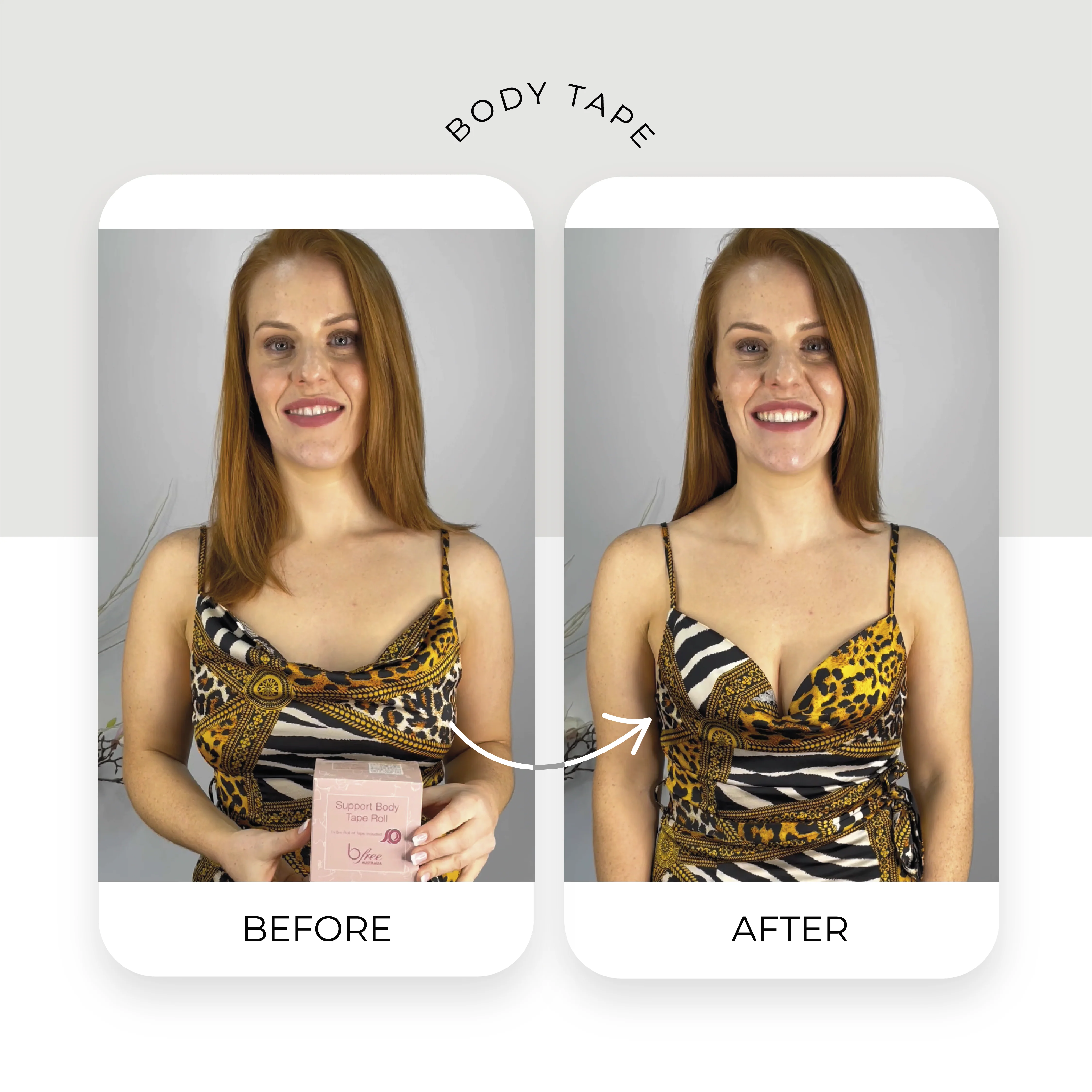 Support Body Tape Roll - Image 4